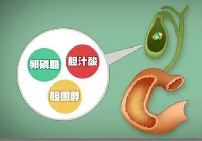 重庆中医肿瘤专家胆囊癌的这些危险因素你知道吗
