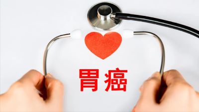 重庆中医肿瘤科医院科普|胃癌的早期症状是什么吗?有什么好的预防方法吗