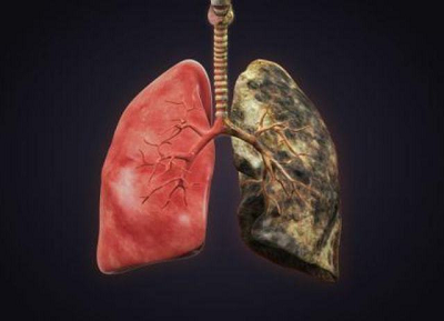 重庆市哪家中医院治疗肺癌厉害?